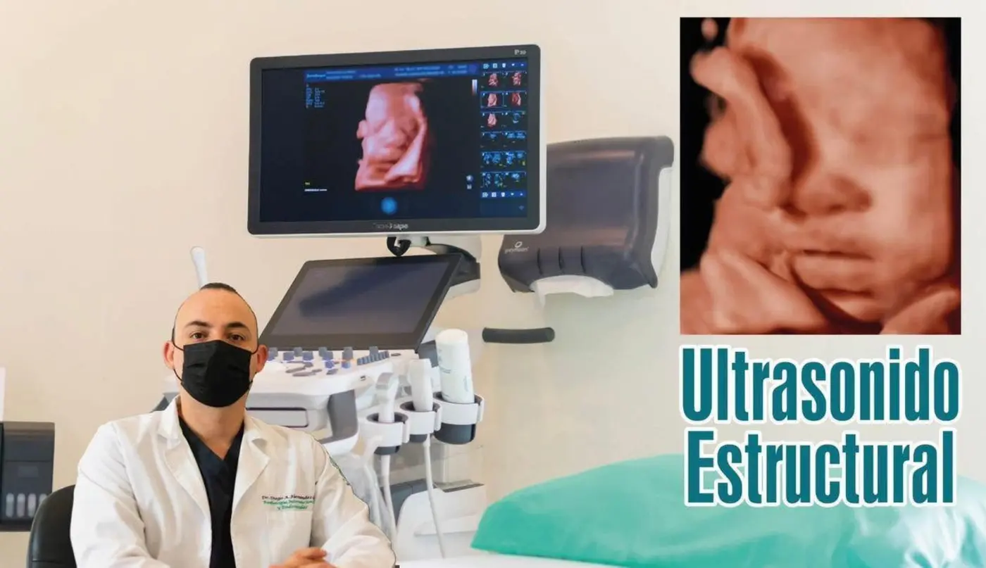 Servicio de ultrasonido estructural